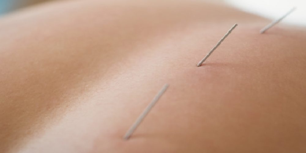 What is the significance of manual physiotherapy?